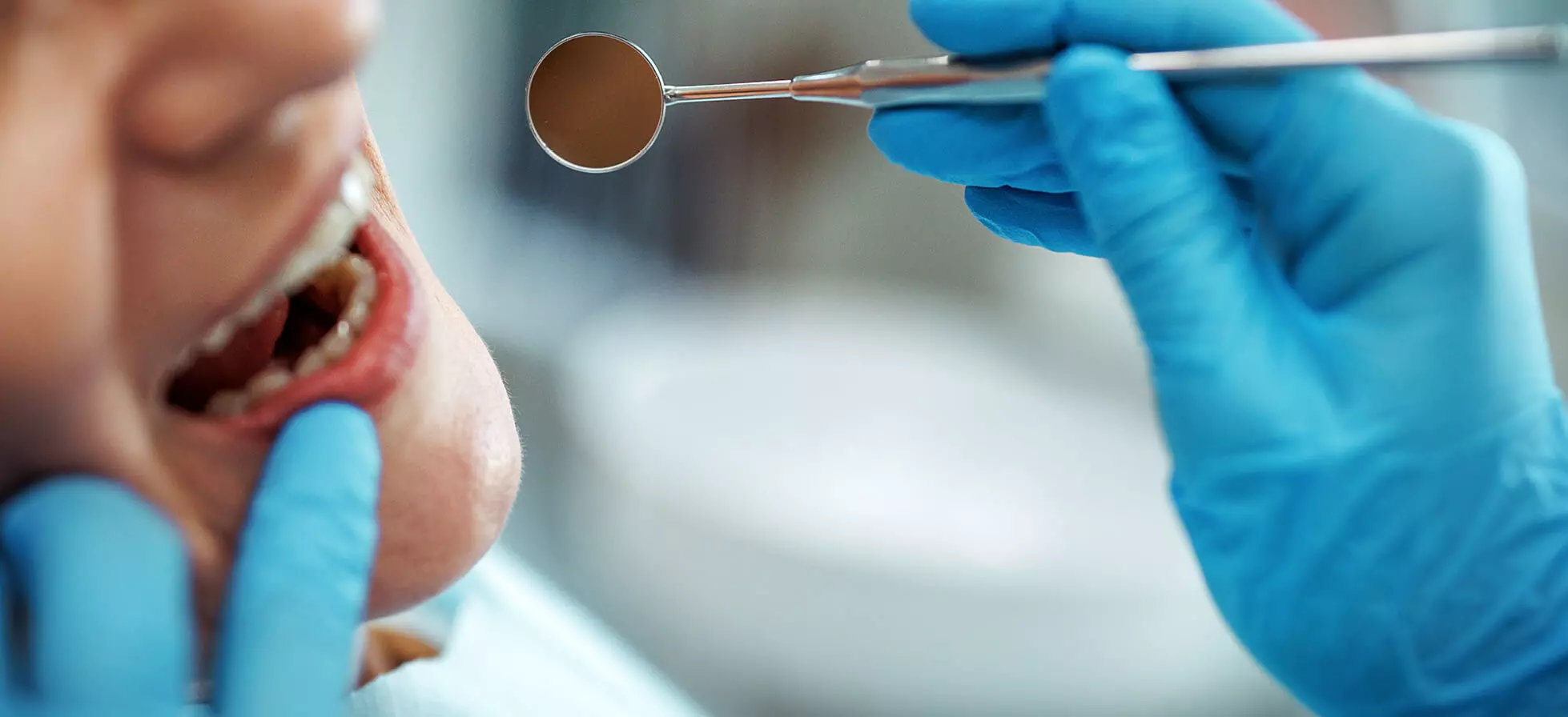 Aftas bucales: qué son y cuándo hay que consultar