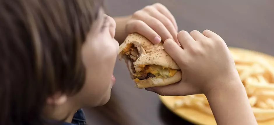 Obesidad infantil: un problema de salud pública