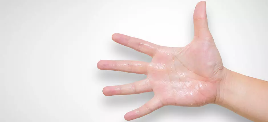 A ponerle fin a la desagradable sudoración excesiva