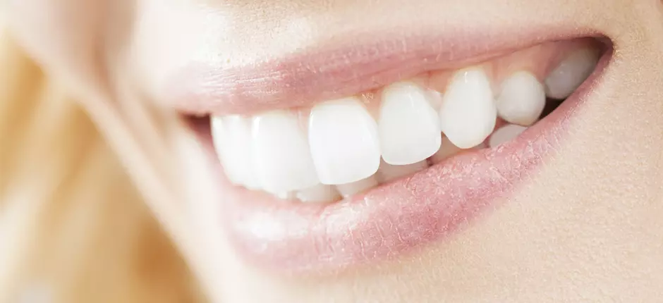 Ortodoncia Osteogénica Acelerada (OOA)