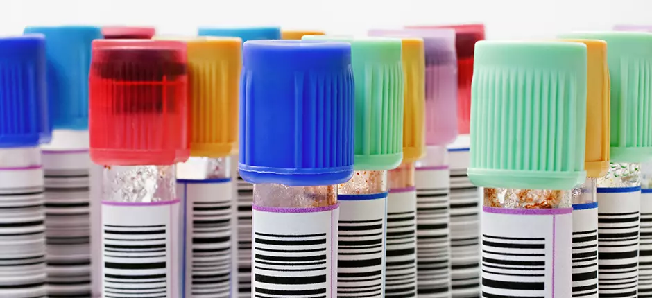 ¿Qué es un hemograma?