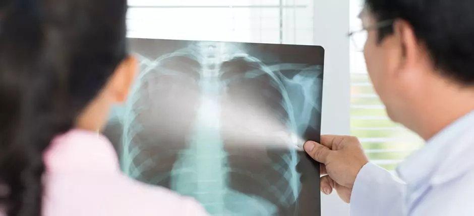 Exámenes radiológicos: qué precauciones hay que tener y cómo prepararse