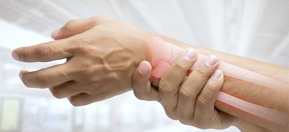 Fractura de muñeca: en qué consiste y cuál es su tratamiento